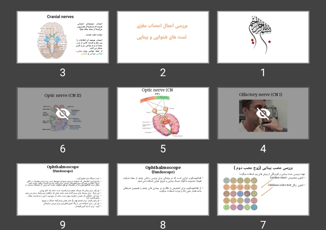 پاورپوینت بررسی اعمال اعصاب مغزی تست های شنوایی و بینایی