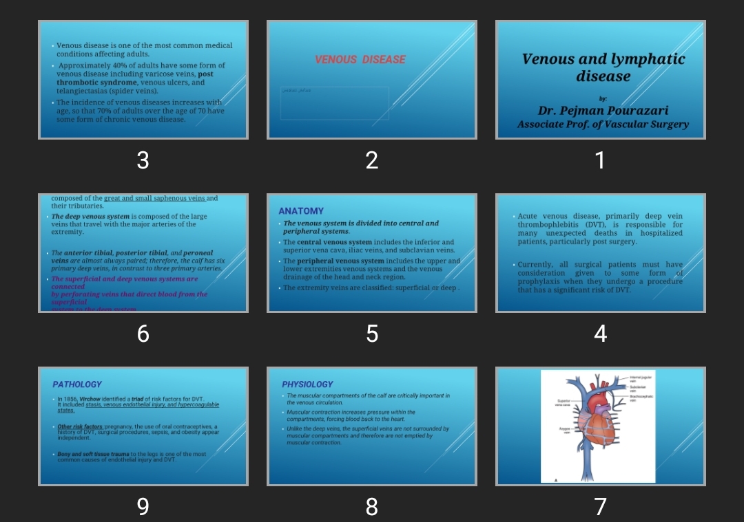 پاورپوینت Venous and lymphatic disease