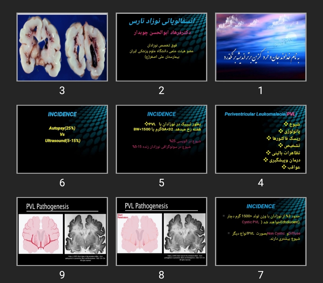 پاورپوینت انسفالوپاتی نوزاد نارس