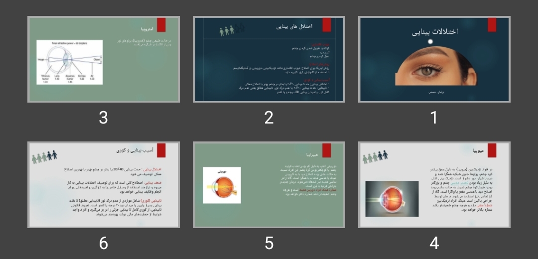 پاورپوینت اختلالات بینایی