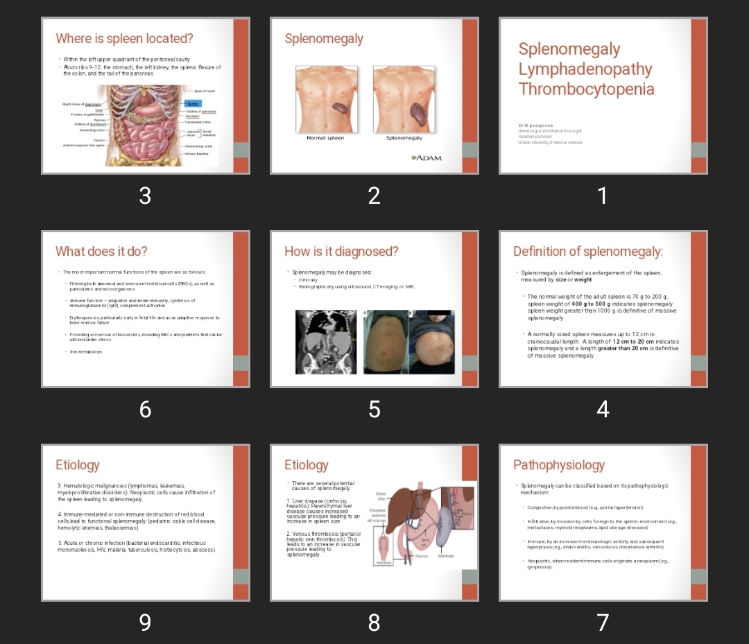 پاورپوینت Splenomegaly Lymphadenopathy Thrombocytopenia