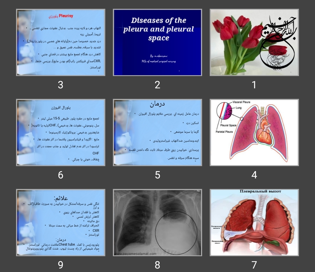 پاورپوینت پلور شغلی Diseases of the pleura and pleural space