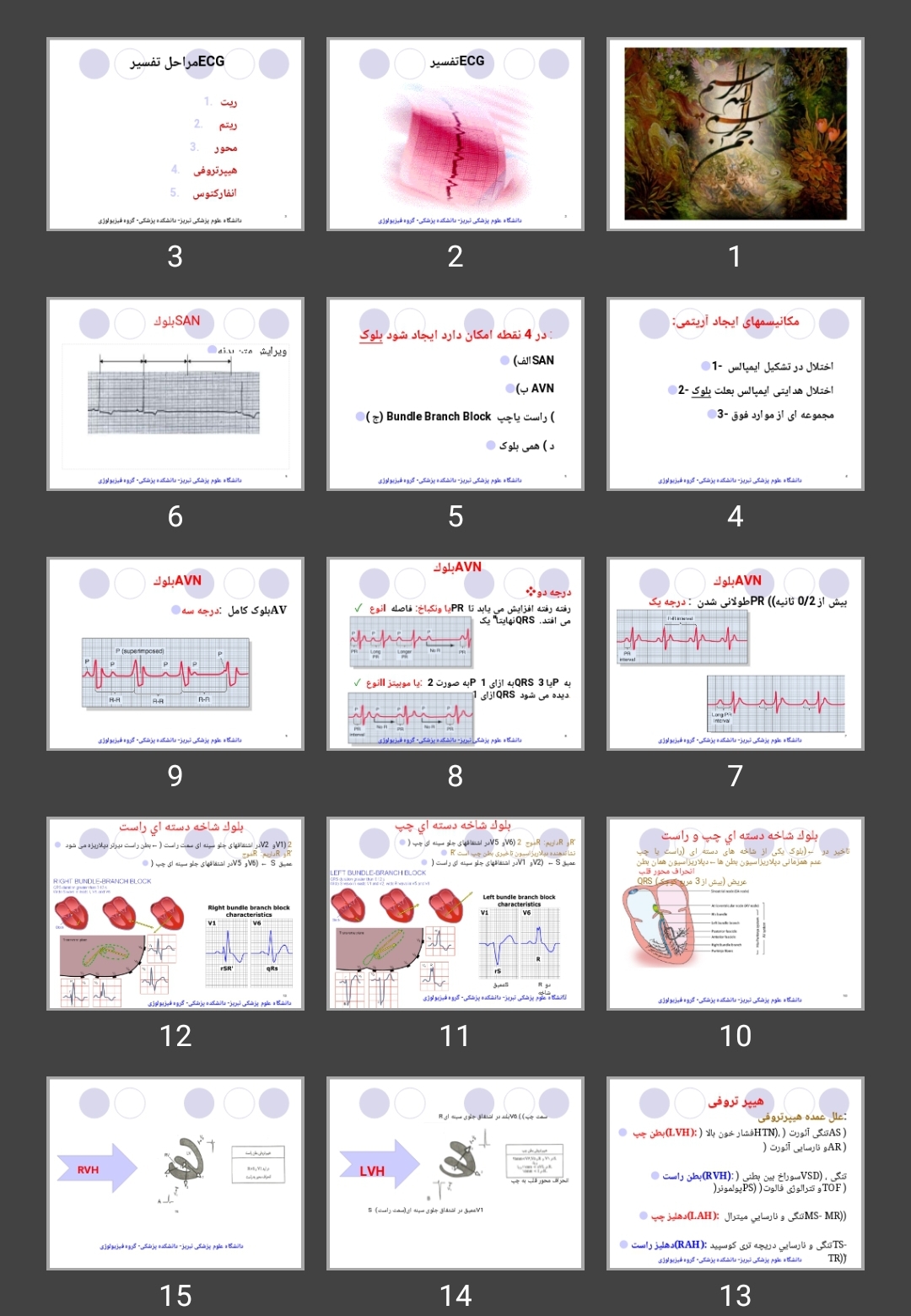 پاورپوینت تفسیر ECG