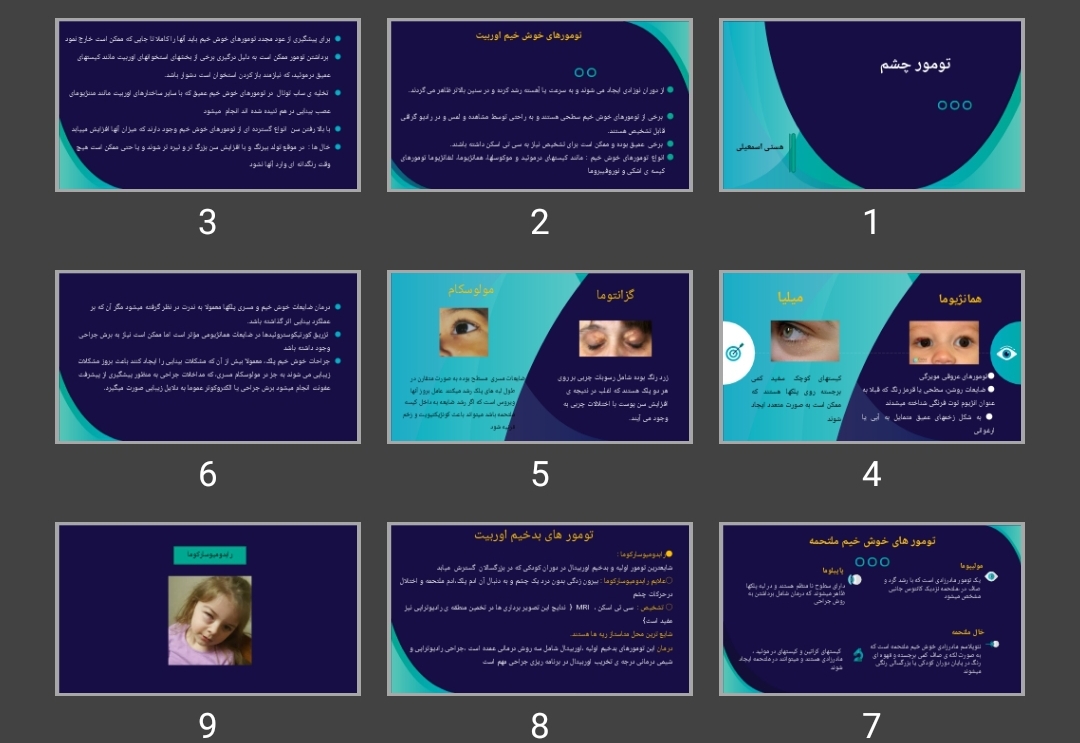 پاورپوینت تومور چشم