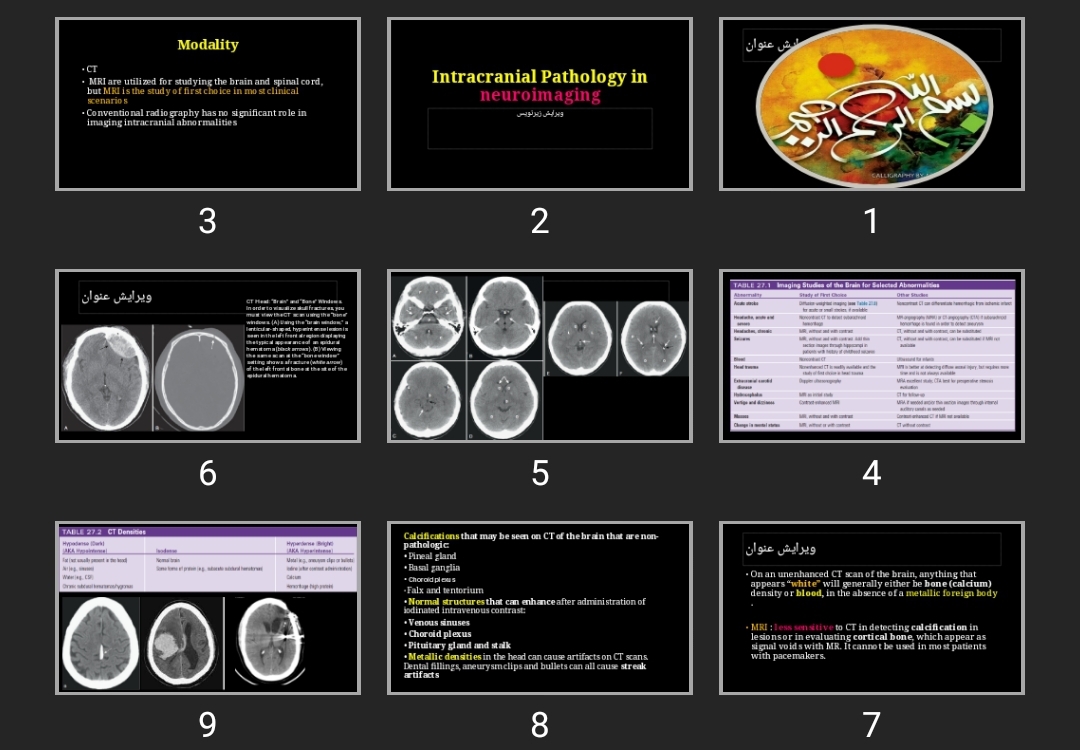 پاورپوینت Intracranial Pathology in neuroimaging