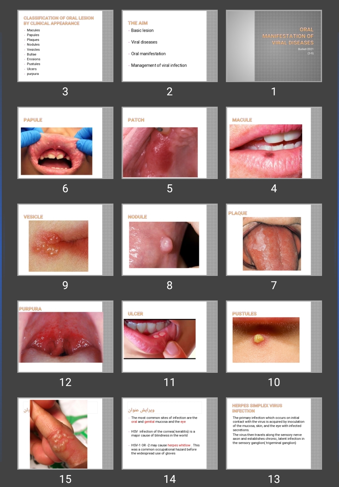 پاورپوینت تظاهرات دهانی ویروسی Oral manifestation of viral diseases