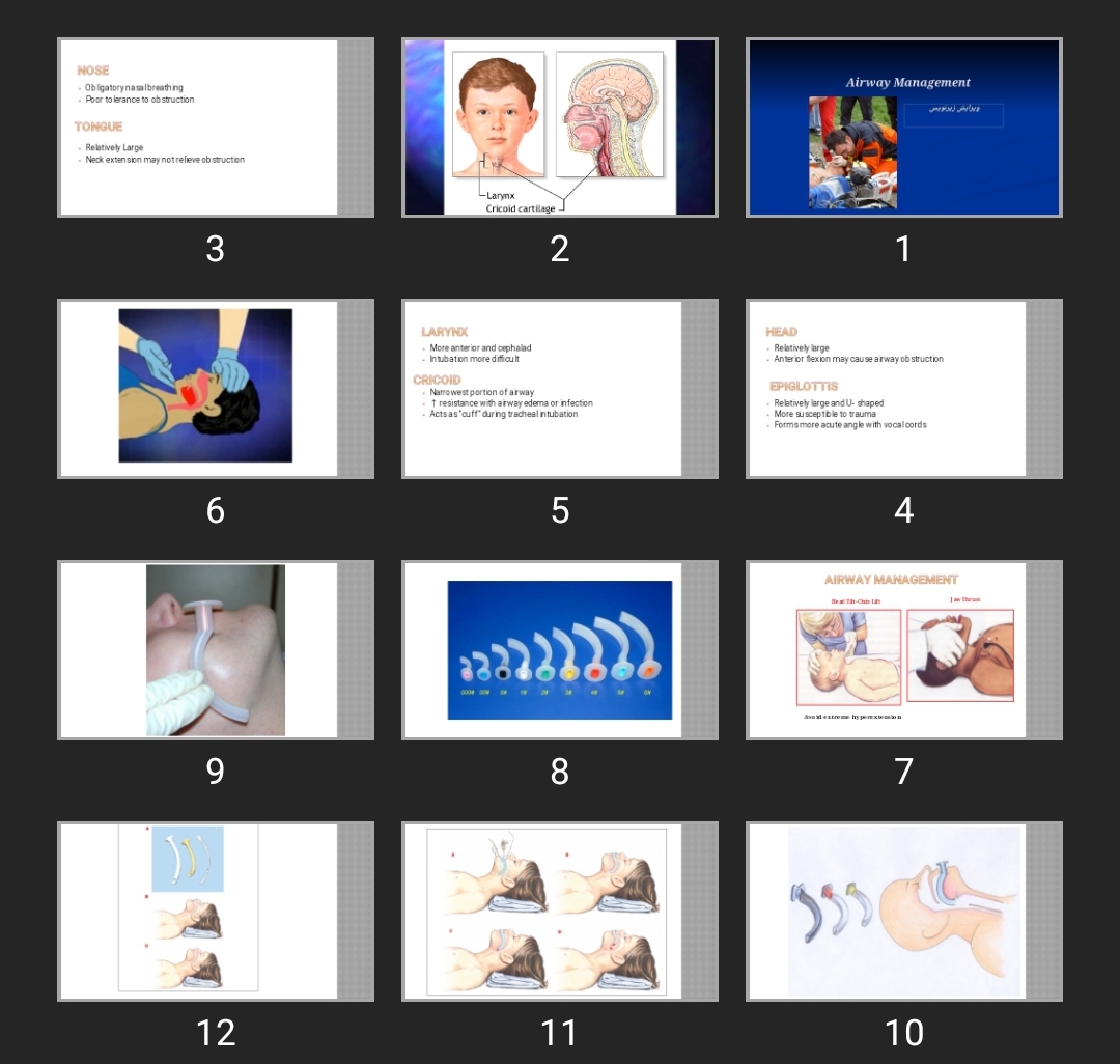 پاورپوینت اداره راه هوایی در کودکان Airway Management