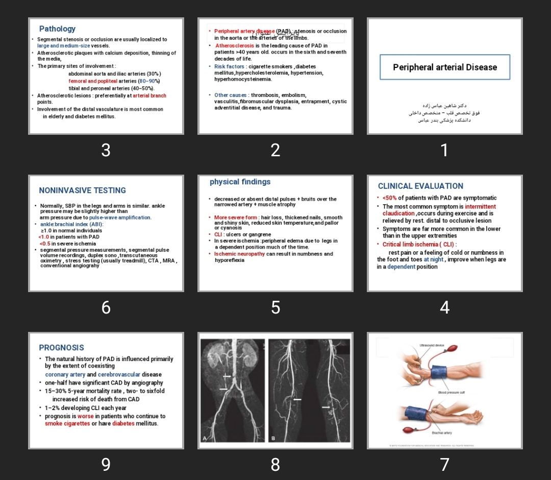 پاورپوینت Peripheral arterial Disease