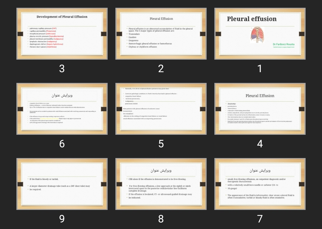 پاورپوینت Pleural effusion