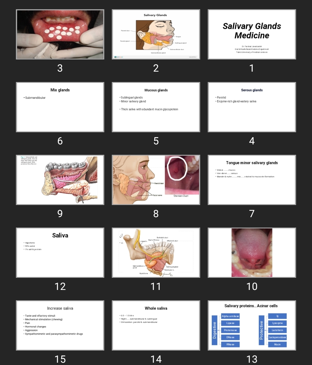 پاورپوینت Salivary Glands Medicine