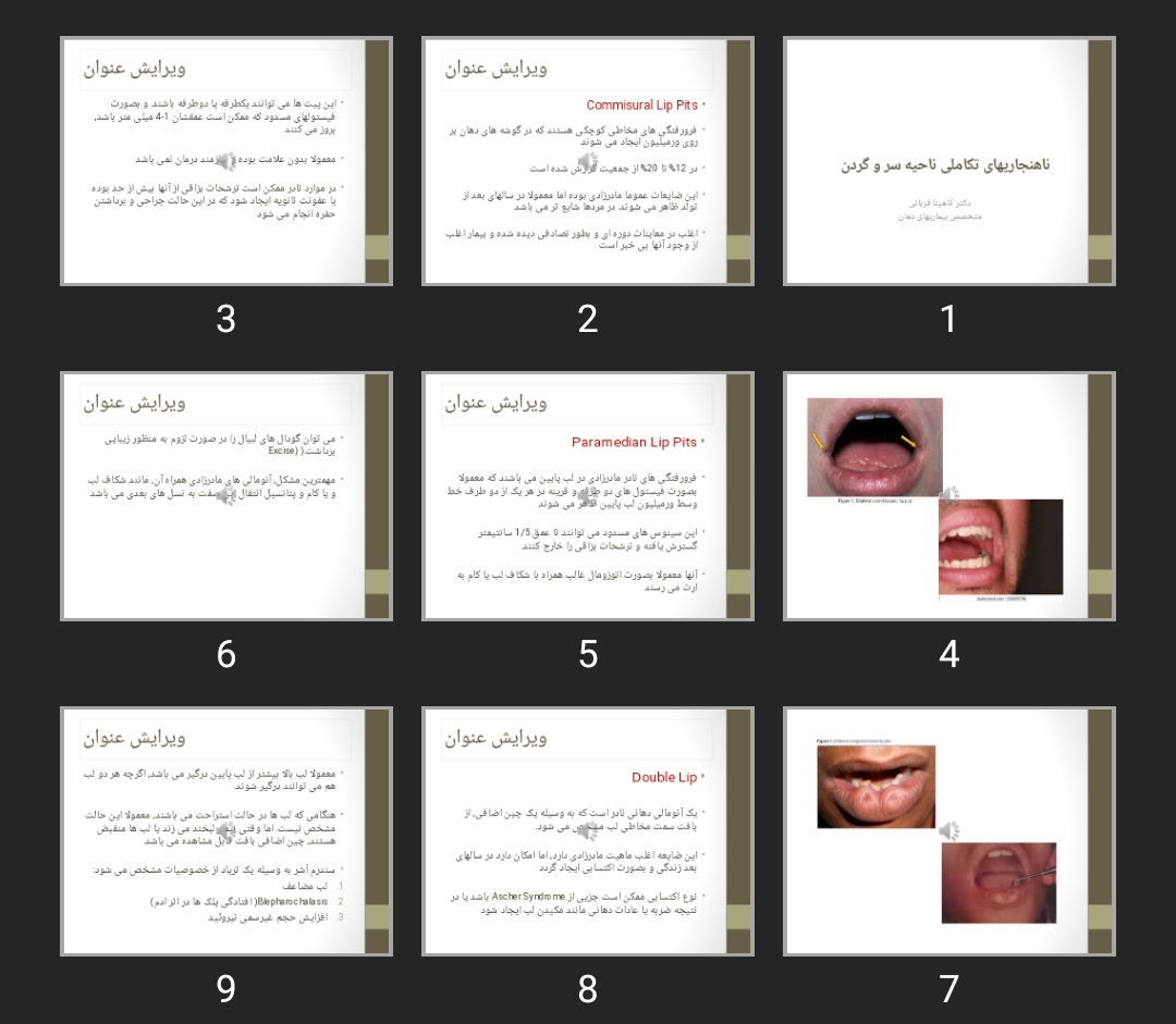 پاورپوینت ناهنجاری های تکاملی ناحیه سر و گردن