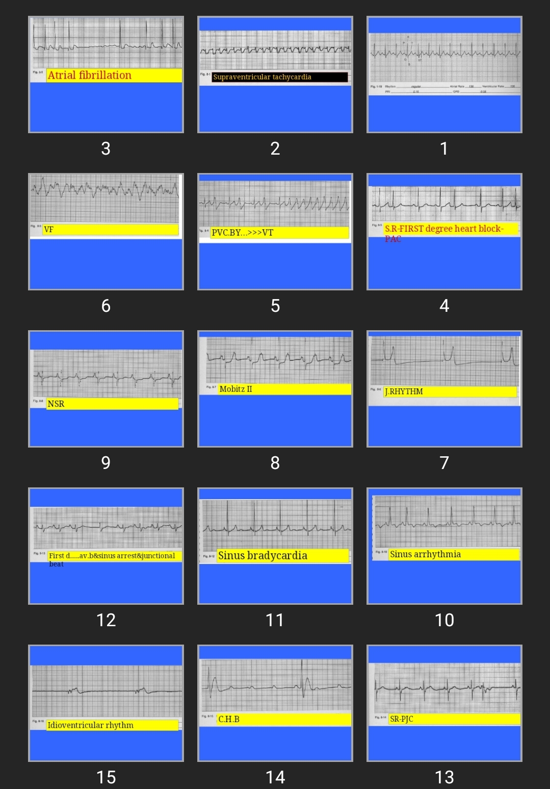 پاورپوینت Strip Test