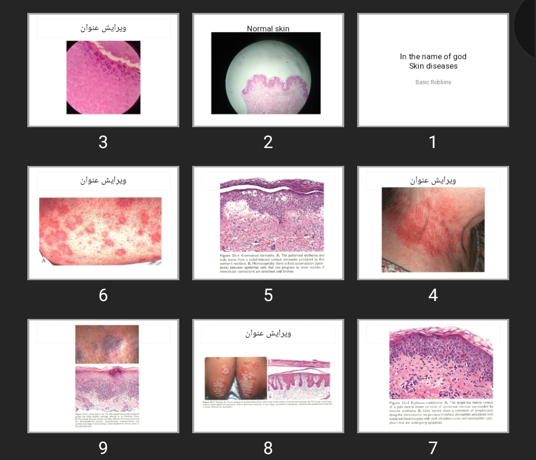 پاورپوینت Skin diseases