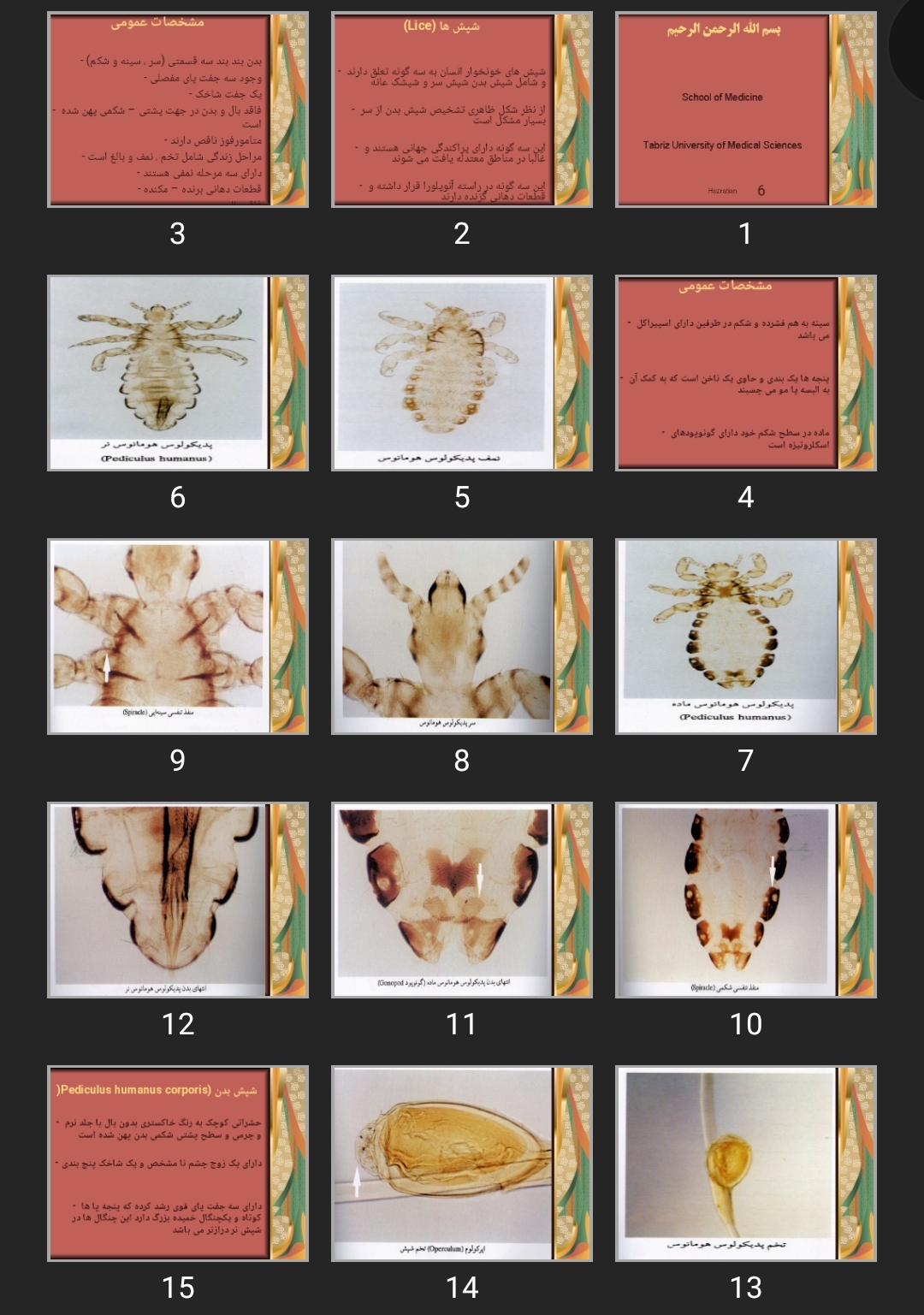 پاورپوینت (Lice) شپش ها