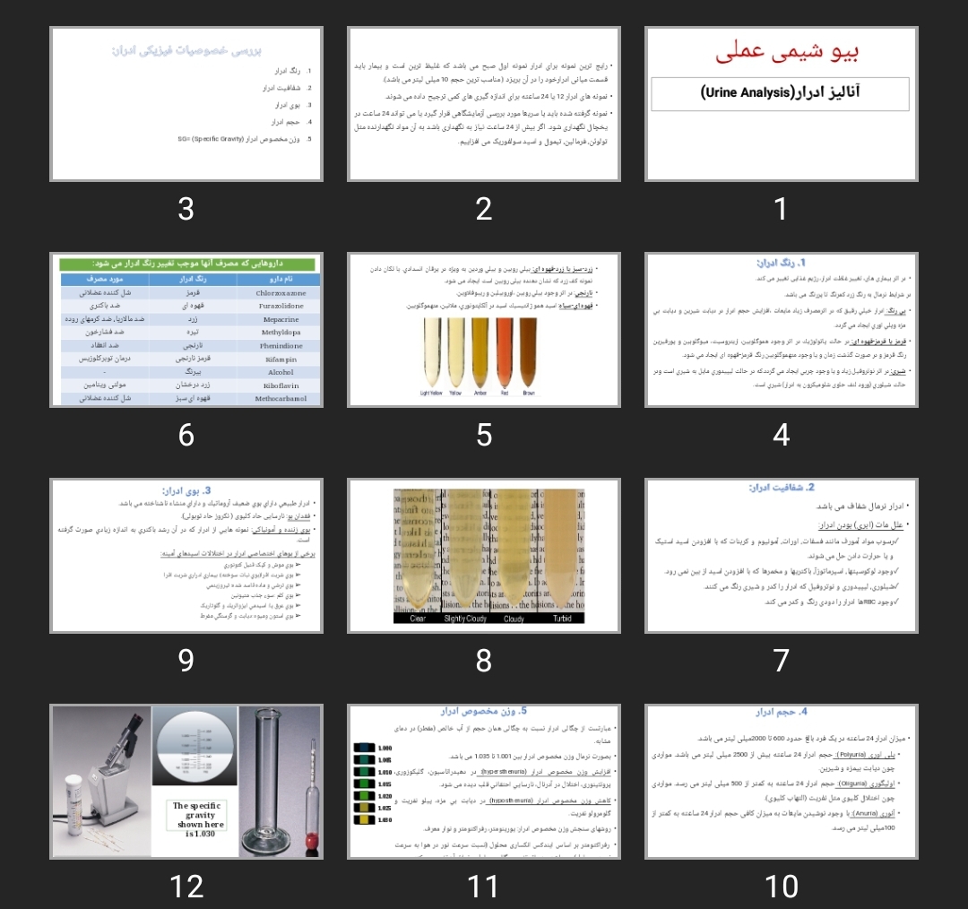 پاورپوینت Urine Analysis آنالیز ادرار