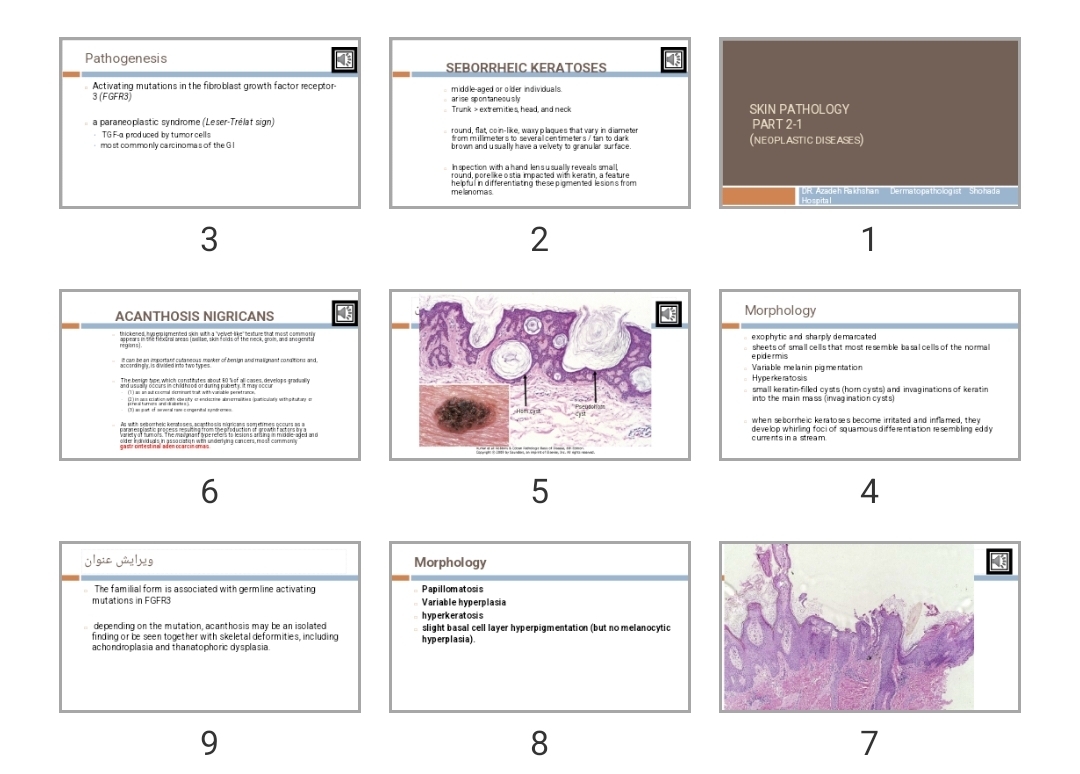 پاورپوینت Skin Pathology  part 2-1 (Neoplastic diseases)