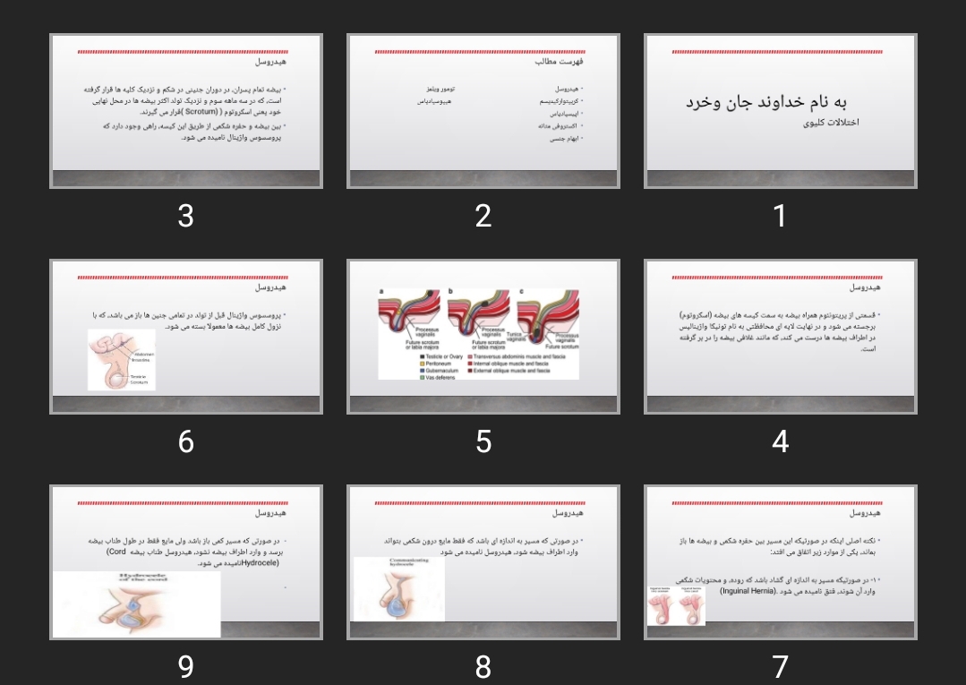 پاورپوینت اختلالات کلیوی