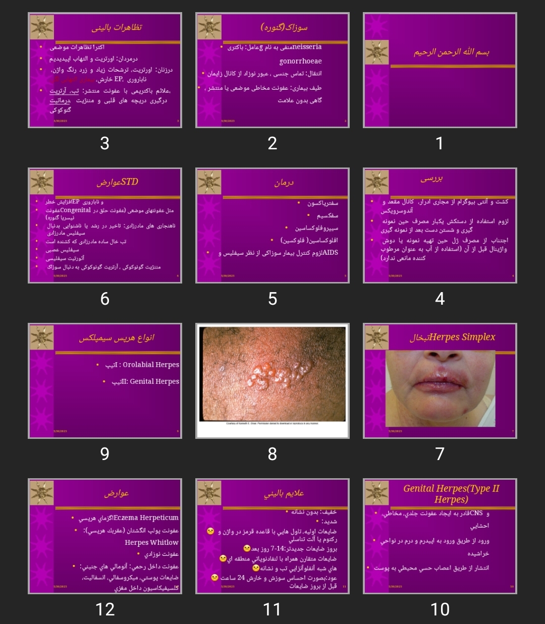 پاورپوینت Infection 2