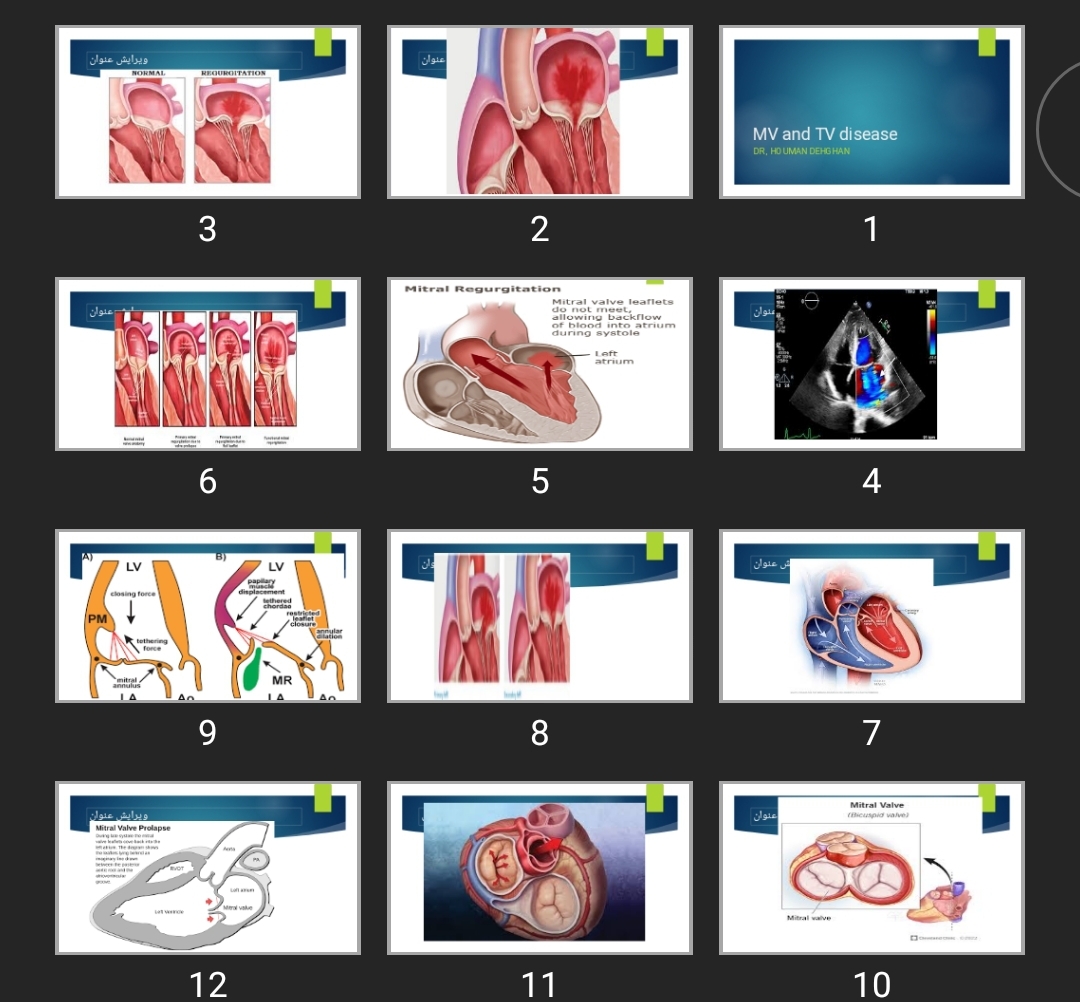 پاورپوینت MV and TV disease