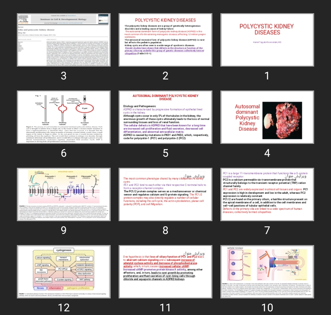 پاورپوینت POLYCYSTIC KIDNEY DISEASES
