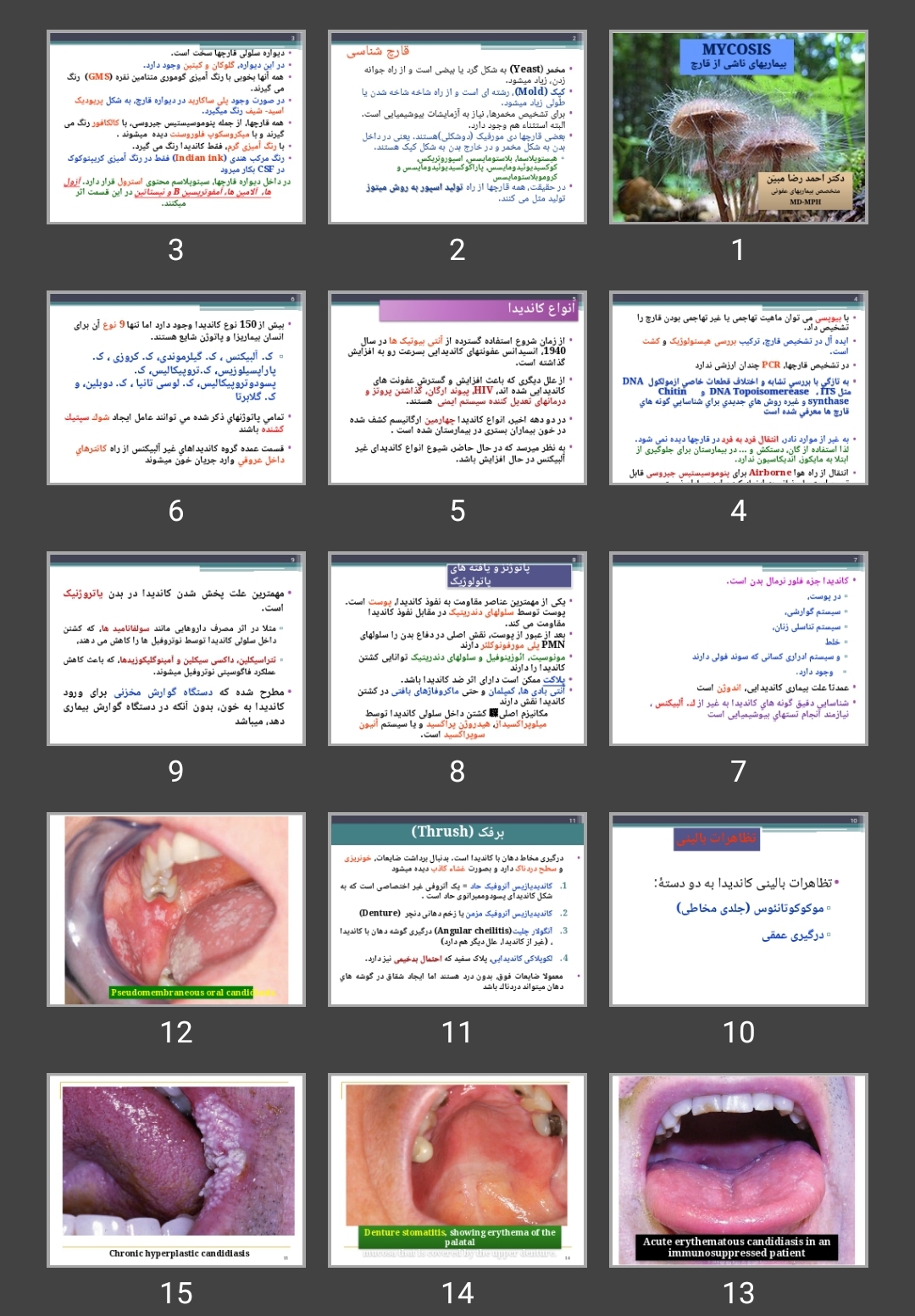 پاورپوینت بیماری های ناشی از قارچ Mycosis