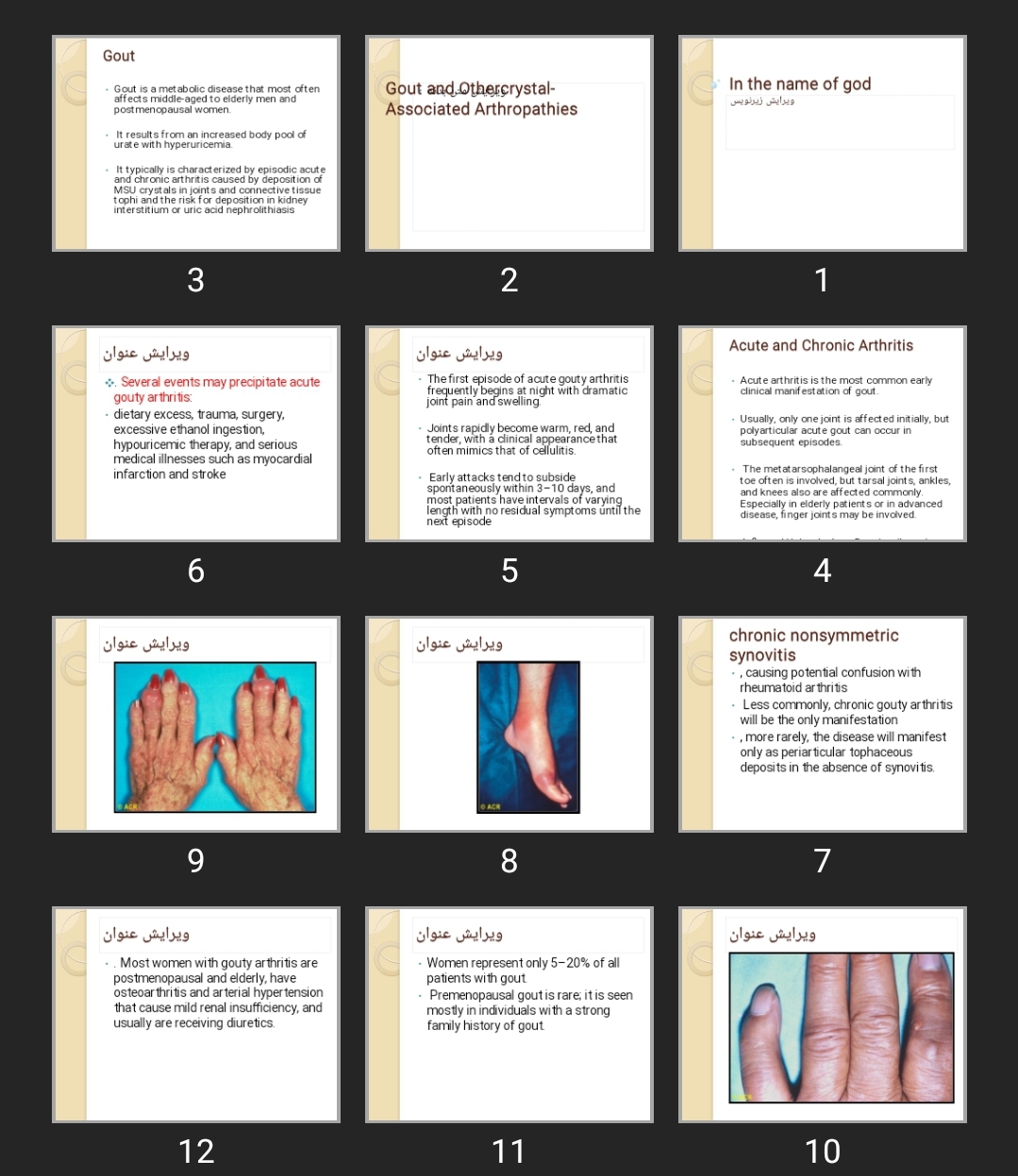 پاورپوینت Gout and Othercrystal-Associated Arthropathies