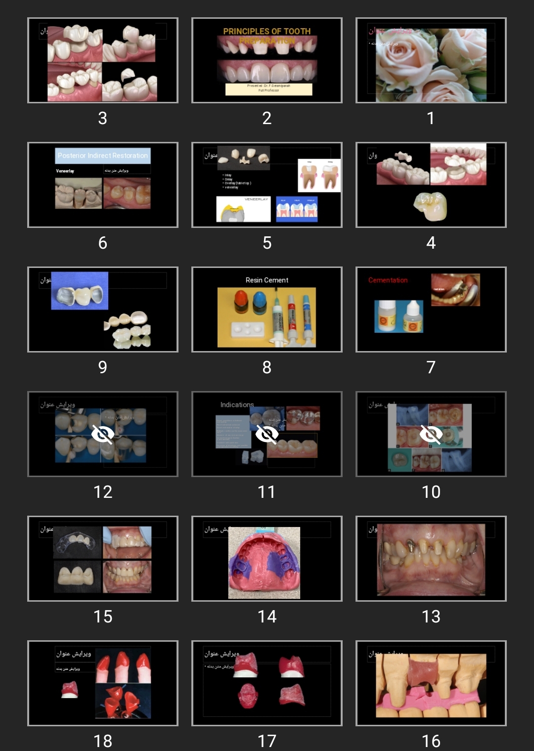 پاورپوینت PRINCIPLES OF TOOTH PREPARATION