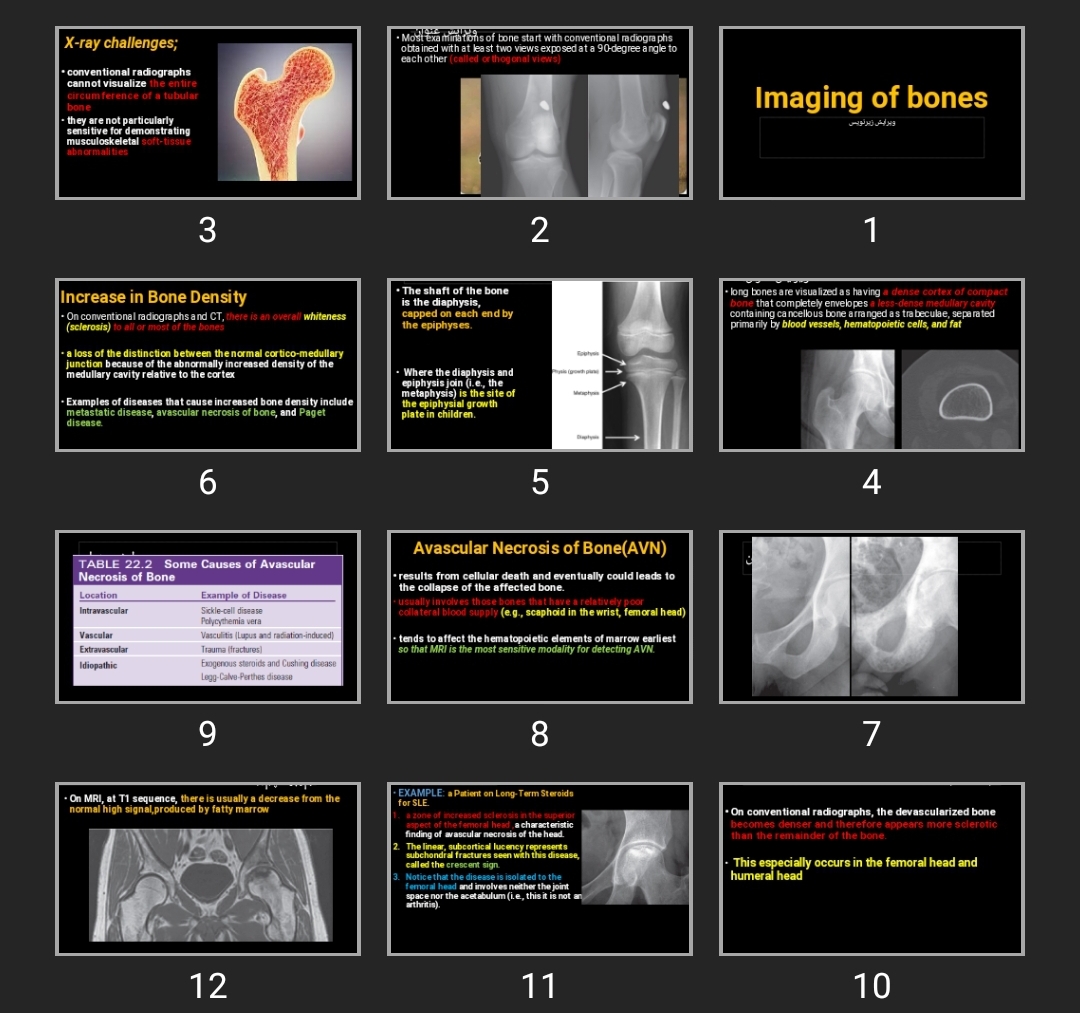 پاورپوینت Imaging of bones
