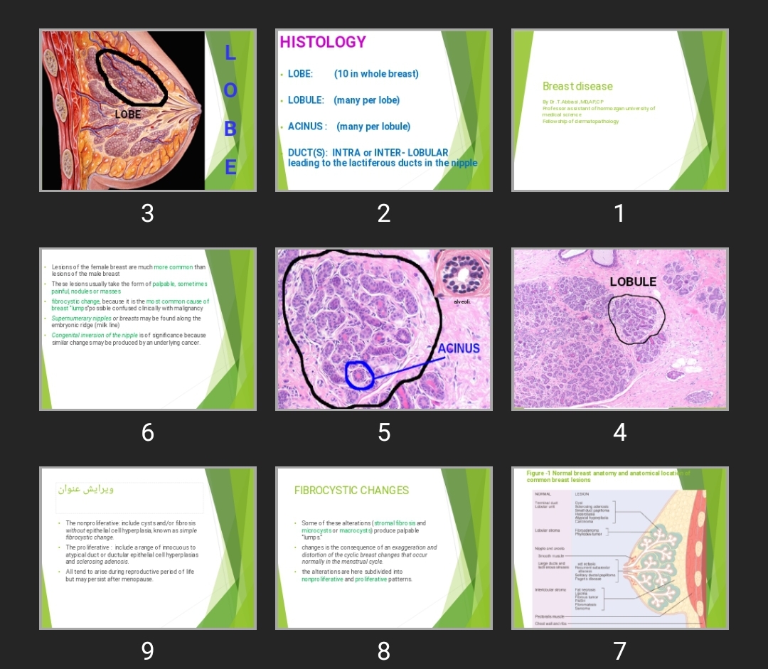 پاورپوینت Breast disease