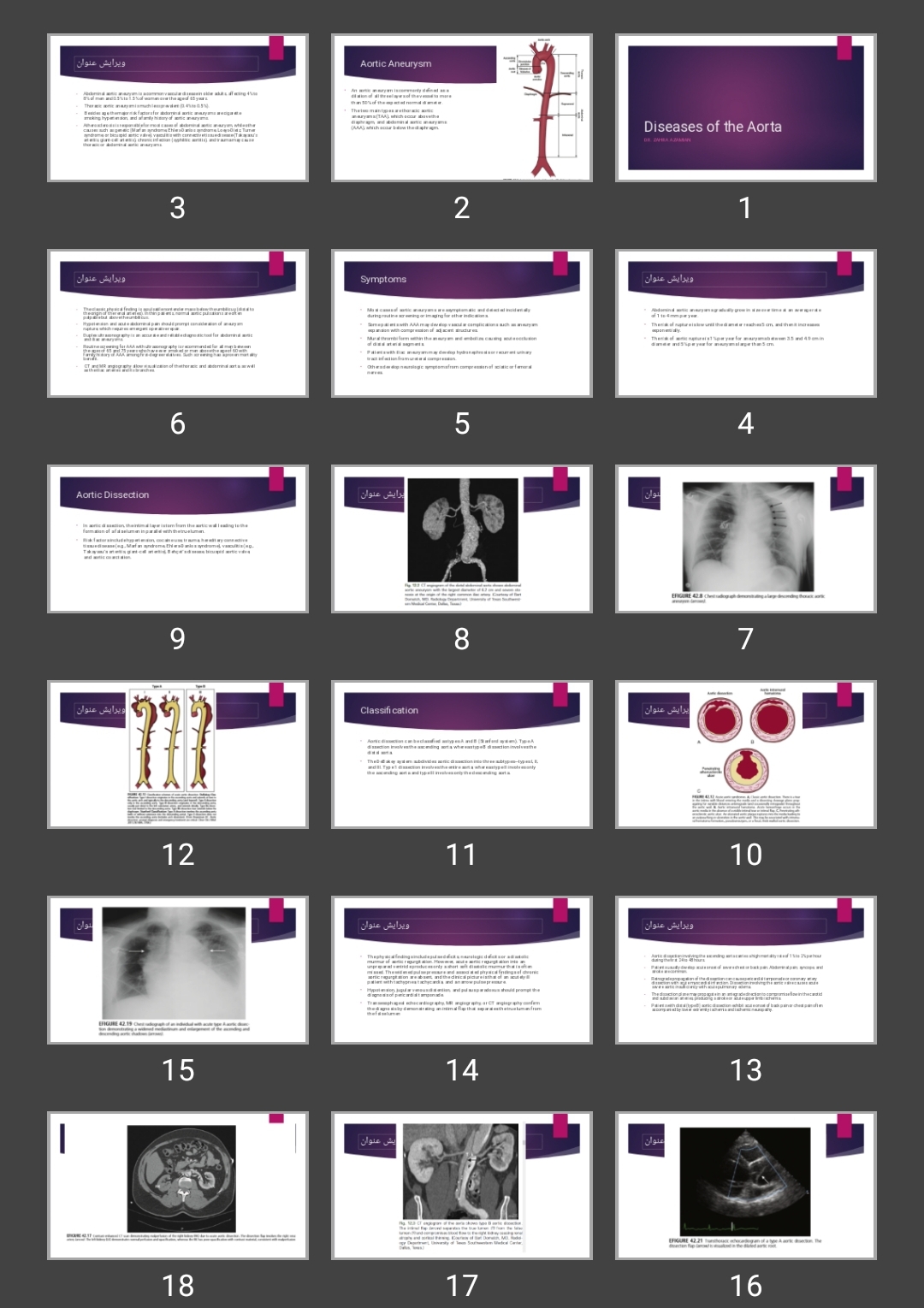 پاورپوینت بیماری های آئورت Diseases of the Aorta