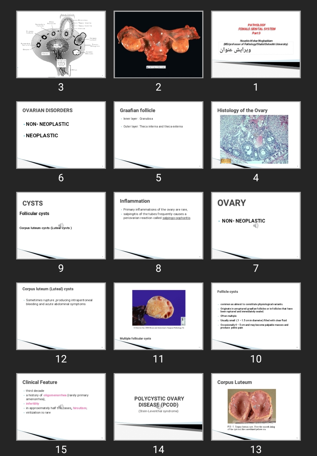 پاورپوینت PATHOLOGY FEMALE GENITAL SYSTEM Part 3