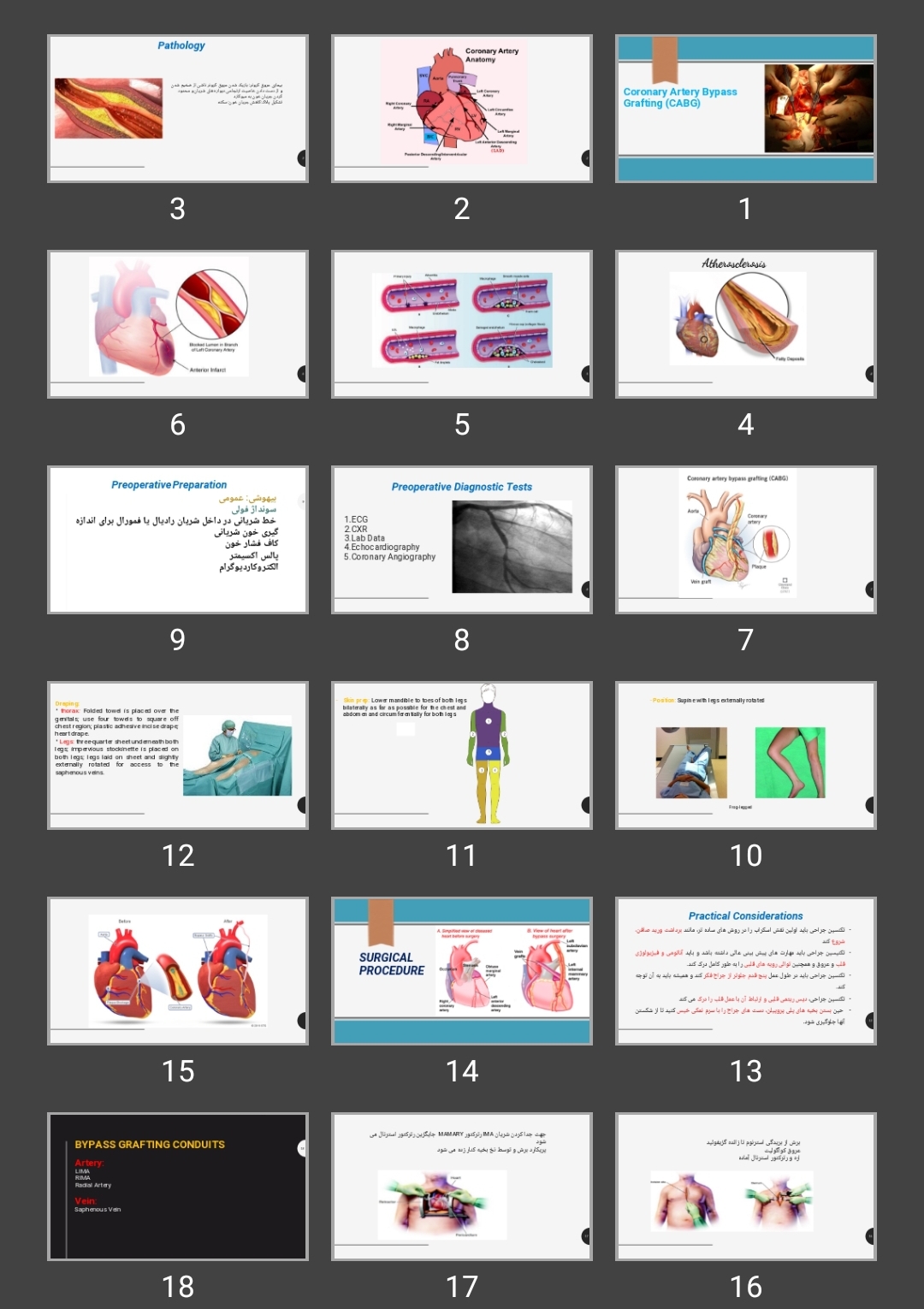 پاورپوینت Coronary Artery Bypass Grafting (CABG)