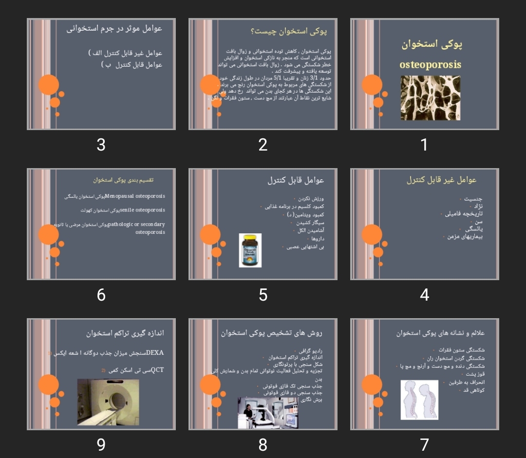 پاورپوینت پوکی استخوان