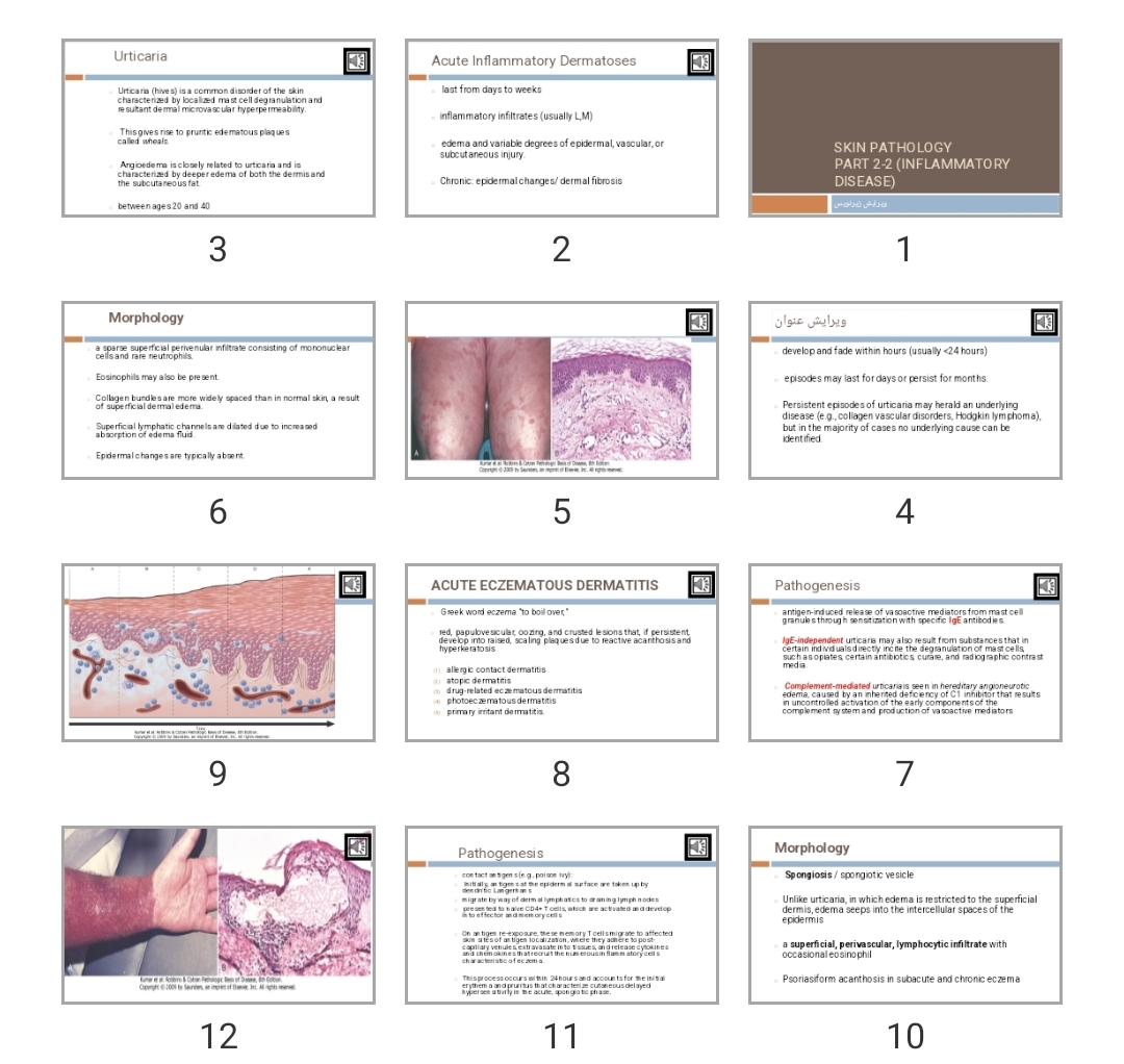 پاورپوینت skin Pathology Part 2-2 (Inflammatory disease)