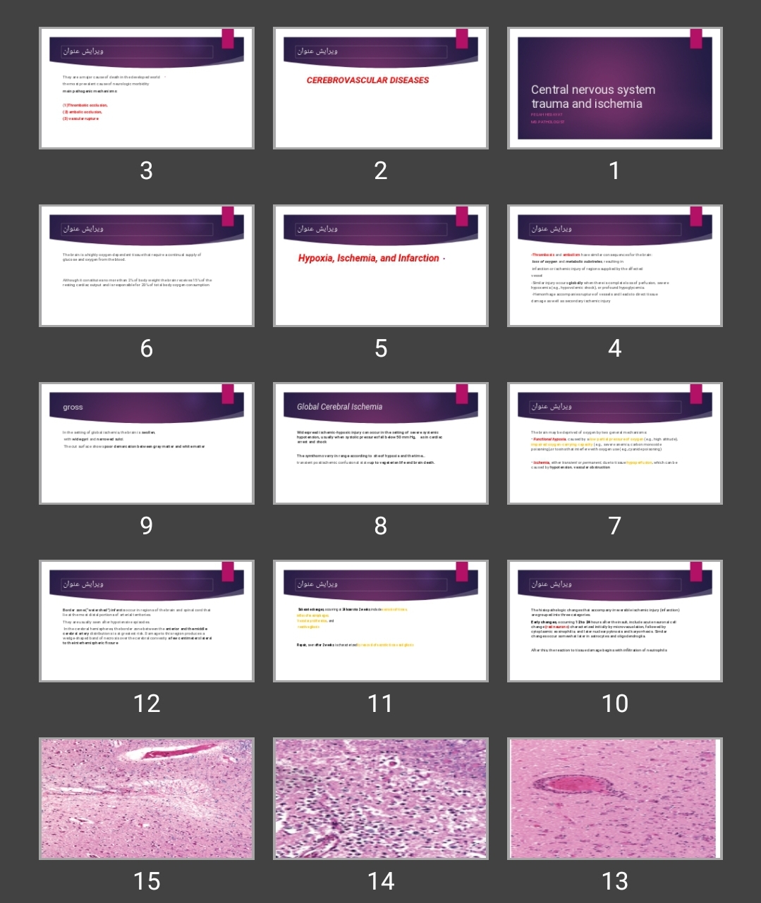 پاورپوینت Central nervous system trauma and ischemia