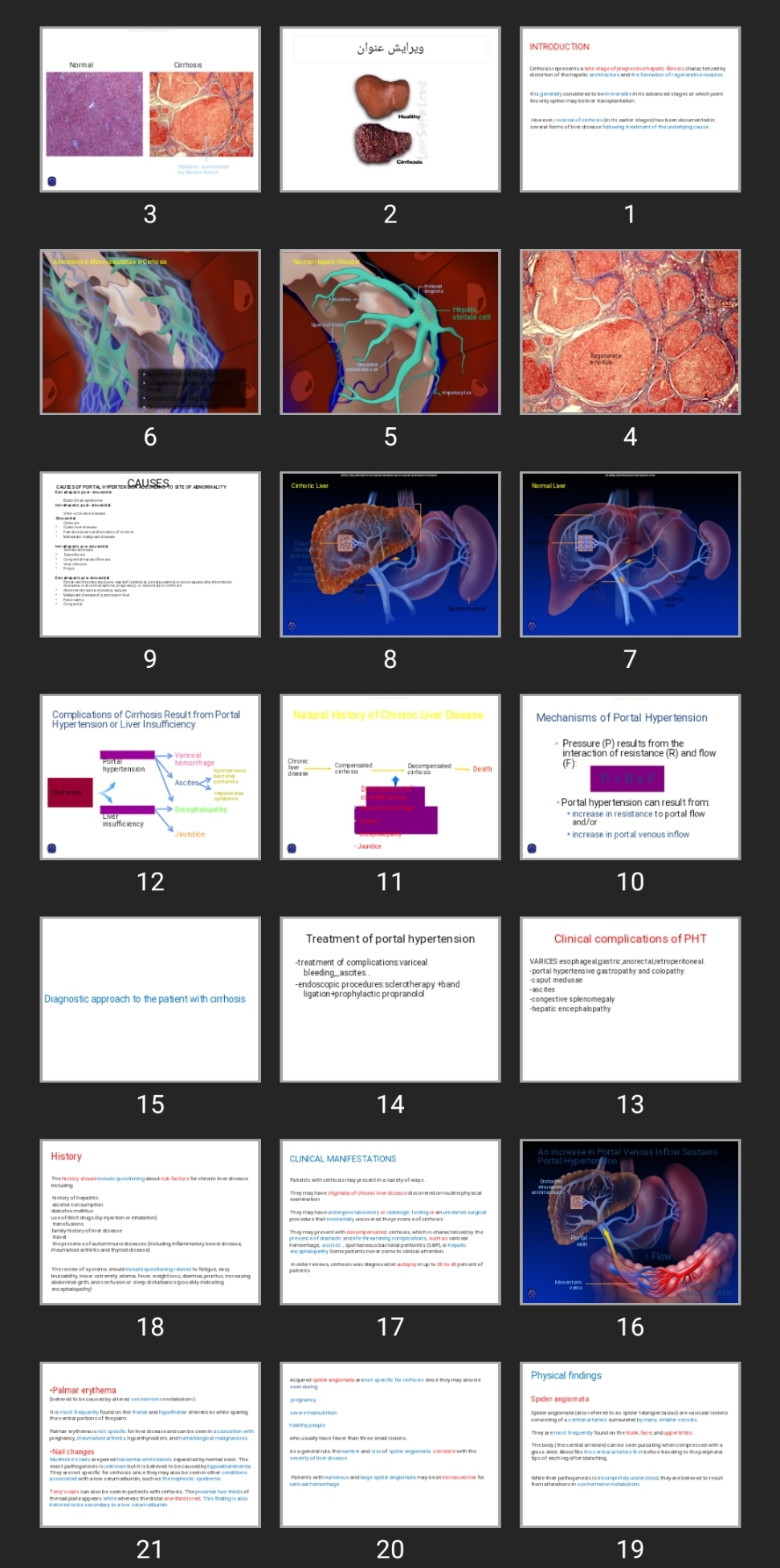 پاورپوینت Cirrhosis Fliver