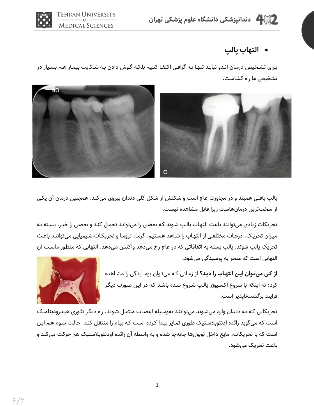 جزوه کمپلکس پالپ و پری‌اپیکال - بیماری‌های پالپ: یافته‌های هیستولوژیک، کلینیکی و رادیوگرافیک