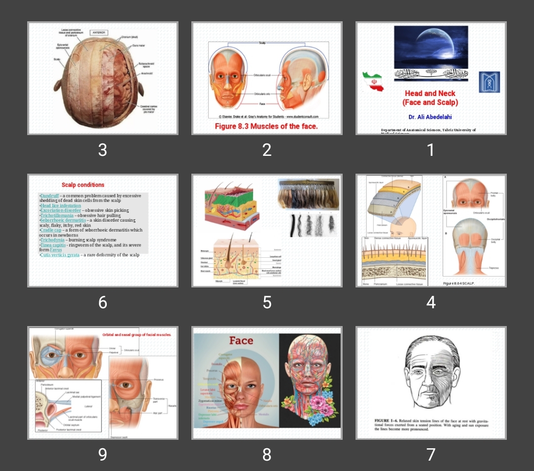 پاورپوینت Head and Neck (Face and Scalp)