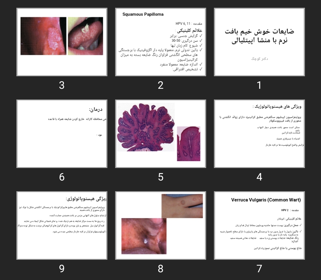 پاورپوینت ضایعات خوش خیم بافت نرم با منشا اپیتلیالی