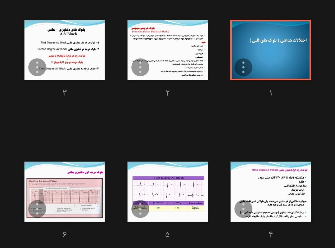جزوه اختلالات هدایتی (بلوک های قلبی)