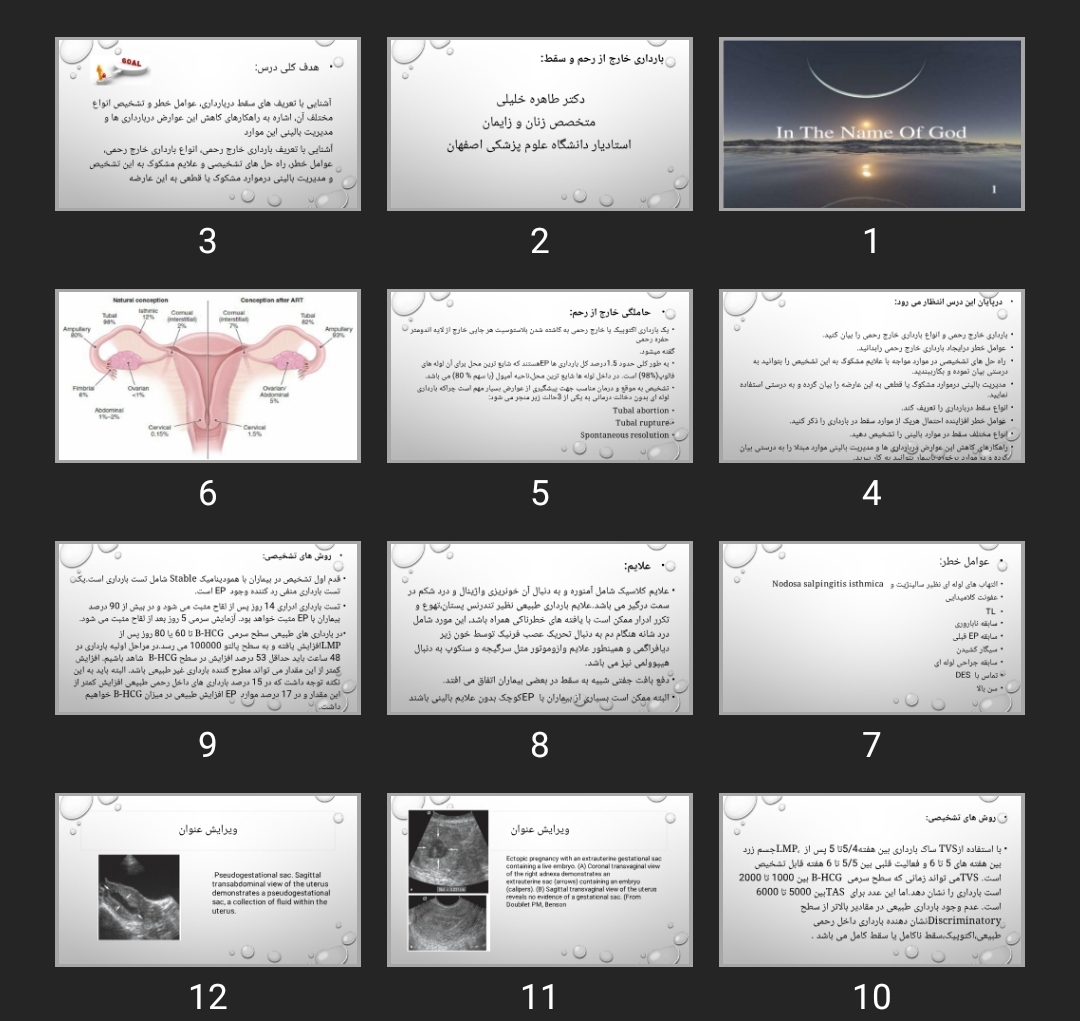 پاورپوینت بارداری خارج از رحم و سقط