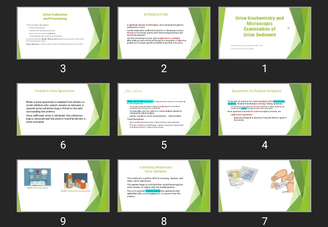 پاورپوینت Urine biochemistry and Microscopic Examination of Urine Sediment