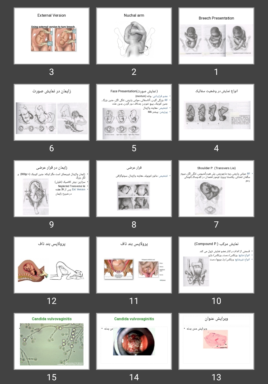 پاورپوینت Breech Presentation