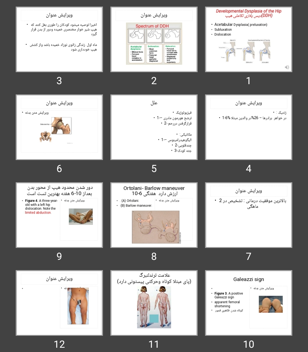 پاورپوینت دیس پلازی تکاملی هیپ