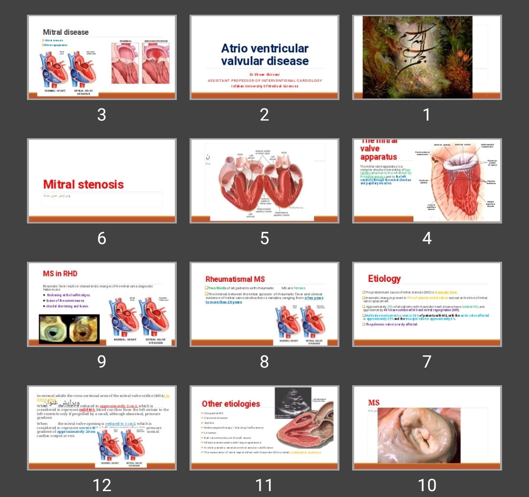 پاورپوینت بیماری دریچه میترال و تریکاسپ Atrio ventricular valvular disease