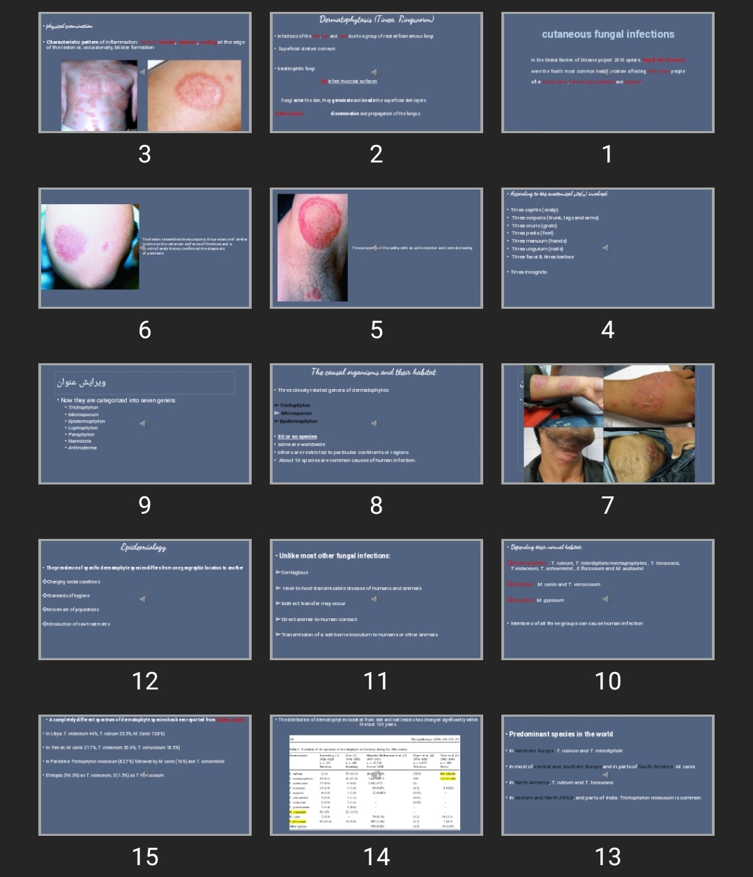 پاورپوینت درماتوفیتوزیس Dermatophytosis