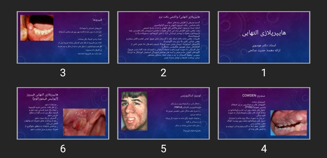 پاورپوینت هایپرپلازی التهابی