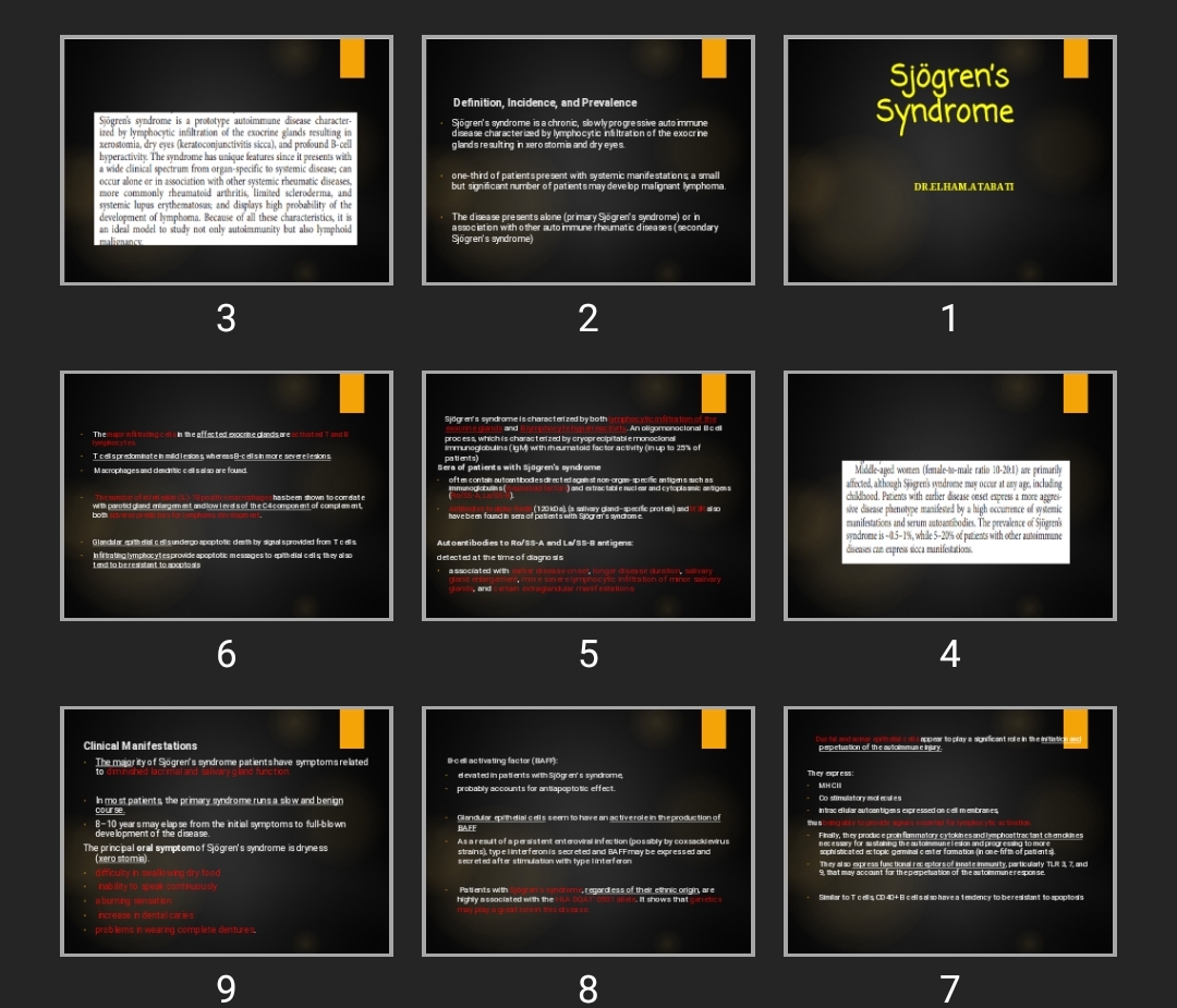 پاورپوینت Sjögren’s Syndrome