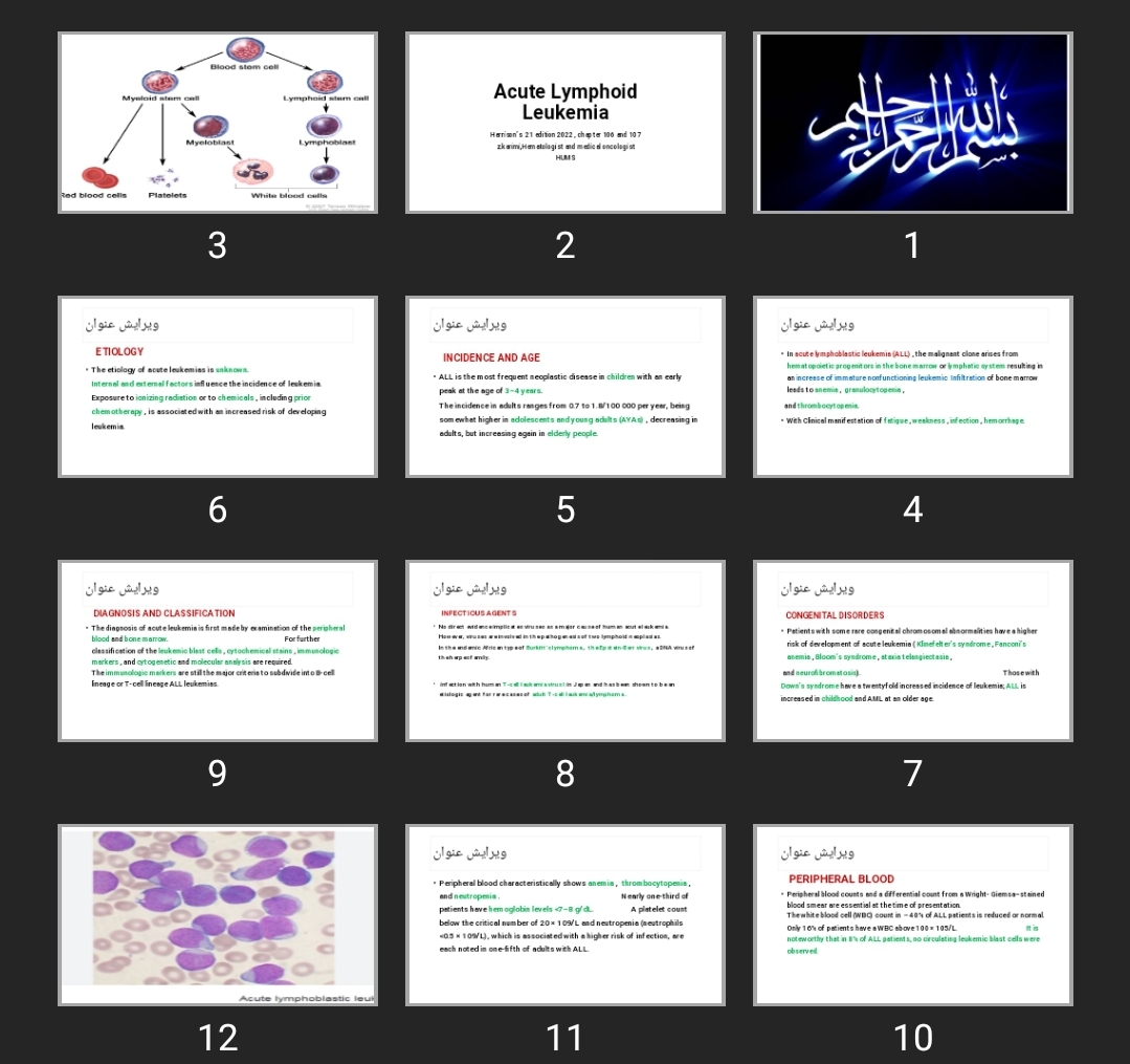 پاورپوینت Acute Lymphoid Leukemia