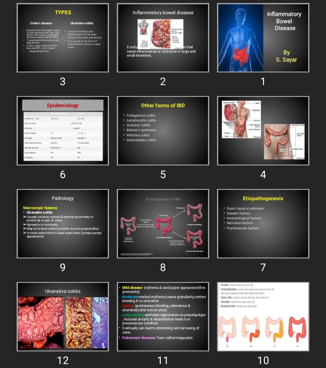 پاورپوینت Inflammatory Bowel Disease